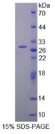 SDS-PAGE (PRLR-720H).jpg